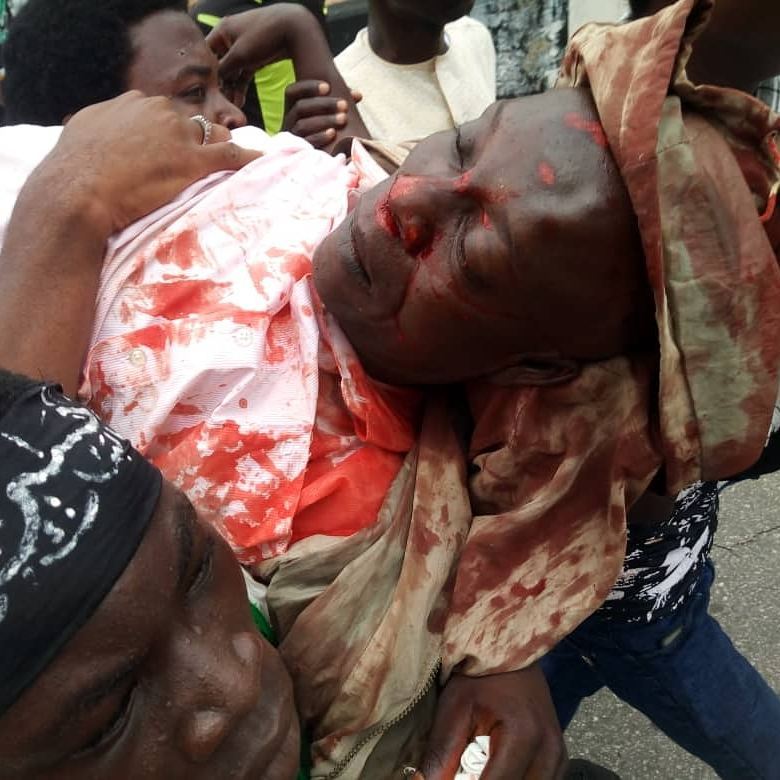 police attack free zakzaky protest in abuja on Mon 23rd july 2019